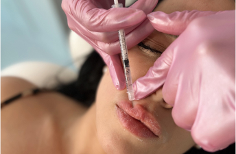 Woman getting an dermal filler treatment at Bella Vida