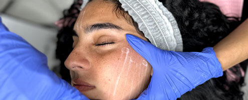 Woman getting a facial rejuvenation at Bella Vida in Miami, FL