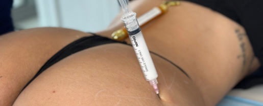 Woman getting an Instant BBL injection treatment at Bella Vida in Miami, FL
